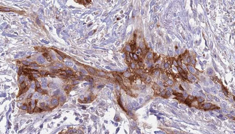 B4GALT1 Antibody