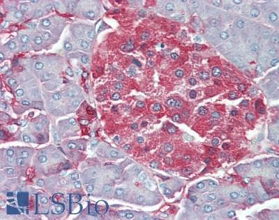 IHC-plus™ GAD 65+67 Antibody (520-600 aa, C-terminal)