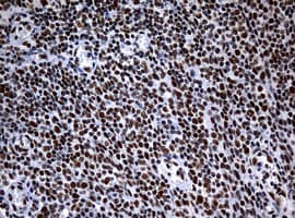 NBN / Nibrin Antibody (clone OTI3A9)