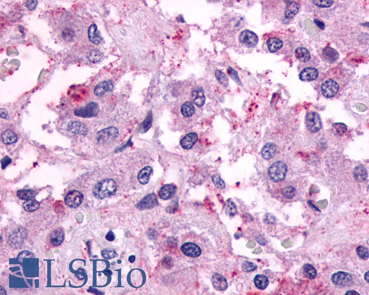 PathPlus™ Polyclonal Rabbit anti-Human F2RL1 / PAR2 Antibody (C-Terminus, IHC)
