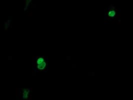 ESRRG / ERR Gamma Antibody (aa24-263, clone OTI5G8)