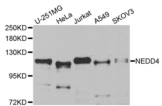 IHC-plus™ Polyclonal Rabbit anti-Human NEDD4 Antibody (IHC, WB)