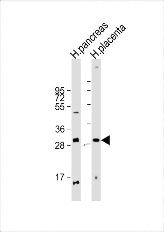 PPP1R3E Antibody (Internal)