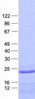 Human ASPDH Protein (Recombinant His, N-Terminal)