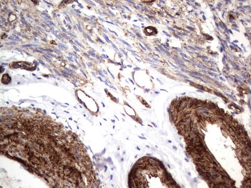 MCAM / CD146 Antibody (clone UMAB154)