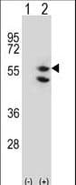 Polyclonal Rabbit anti-Human EFTU / TUFM Antibody (aa342-370, WB)