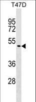 Polyclonal Rabbit anti-Human ZNF557 Antibody (aa92-118, WB)