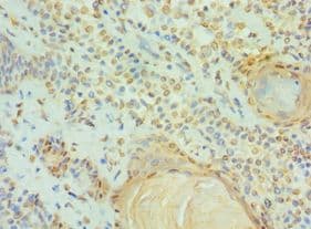 DIS / CCAR1 Antibody (aa1-200)