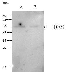 DES / Desmin Antibody (Preservative Free)