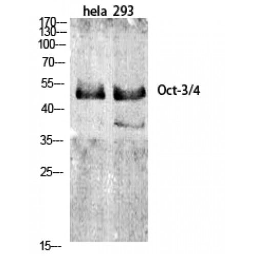 POU5F1 / OCT4 Antibody (160-240 aa, Internal)