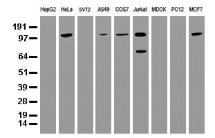 Monoclonal Mouse anti-Human BUB1B / BubR1 Antibody (clone UMAB7, IHC, IF, WB)