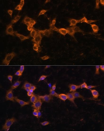 PDGFRB / PDGFR Beta Antibody
