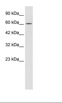 TRIM17 / RNF16 Antibody (aa254-303)