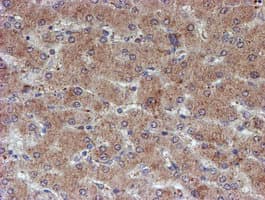 ATRIP Antibody (clone OTI5E7)
