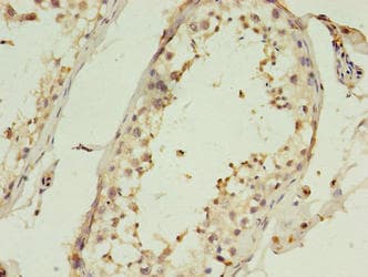 C1QTNF6 / CTRP6 Antibody