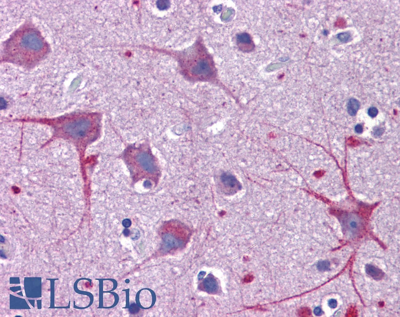 IHC-plus™ SKA1 Antibody