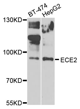 ECE2 Antibody