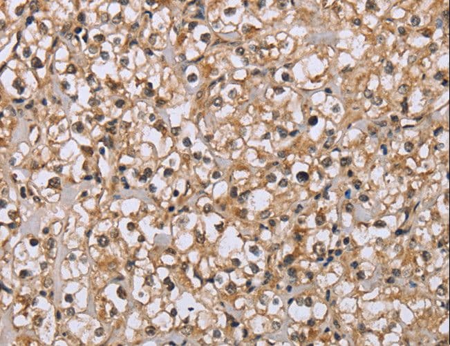Polyclonal Rabbit anti-Human DLD / Diaphorase / E3 Antibody (IHC)