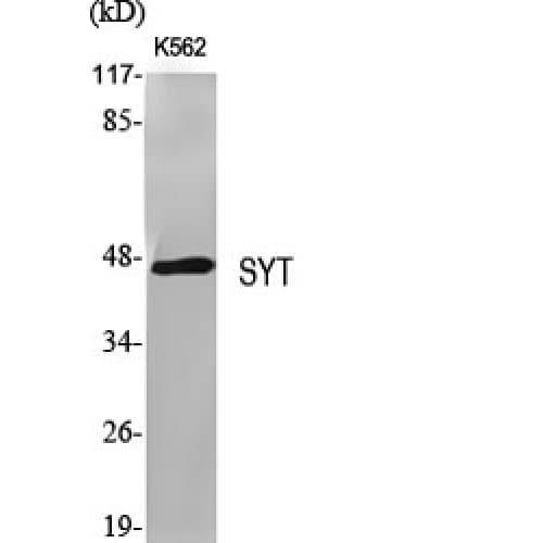 Polyclonal Rabbit anti-Human SS18 Antibody (1-80 aa, N-terminal, IHC, WB)