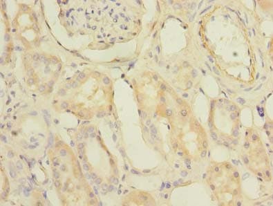 Polyclonal Rabbit anti-Human PDCL2 Antibody (IHC, WB)
