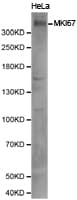 Polyclonal Rabbit anti-Human MKI67 / Ki67 Antibody (IHC, WB)