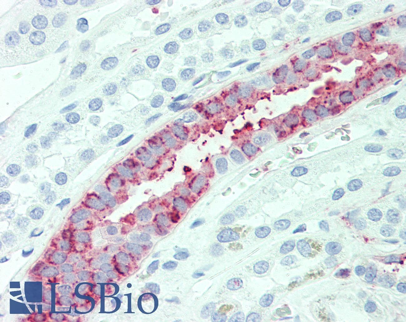IHC-plus™ SLC4A2 / AE2 Antibody (N-Terminus)