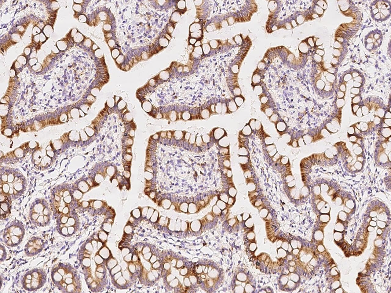 FGF9 Antibody (Preservative Free)