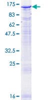 Human PMS2 Protein (Recombinant GST)