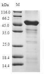 Human ABHD5 Protein (Recombinant 6His-SUMO, N-terminus)