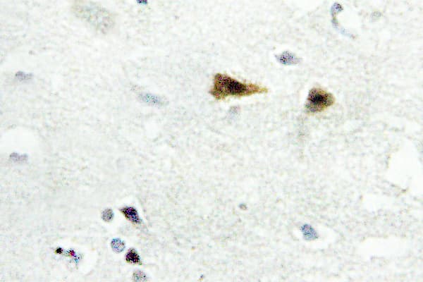 ABL1 / c-ABL Antibody (Glu883)