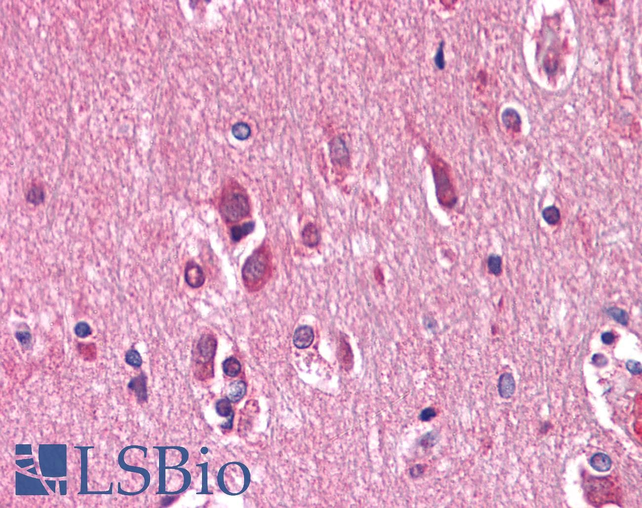IHC-plus™ Monoclonal Mouse anti-Human EPHB3 / EPH Receptor B3 Antibody (clone 4A122D1, IHC, WB)