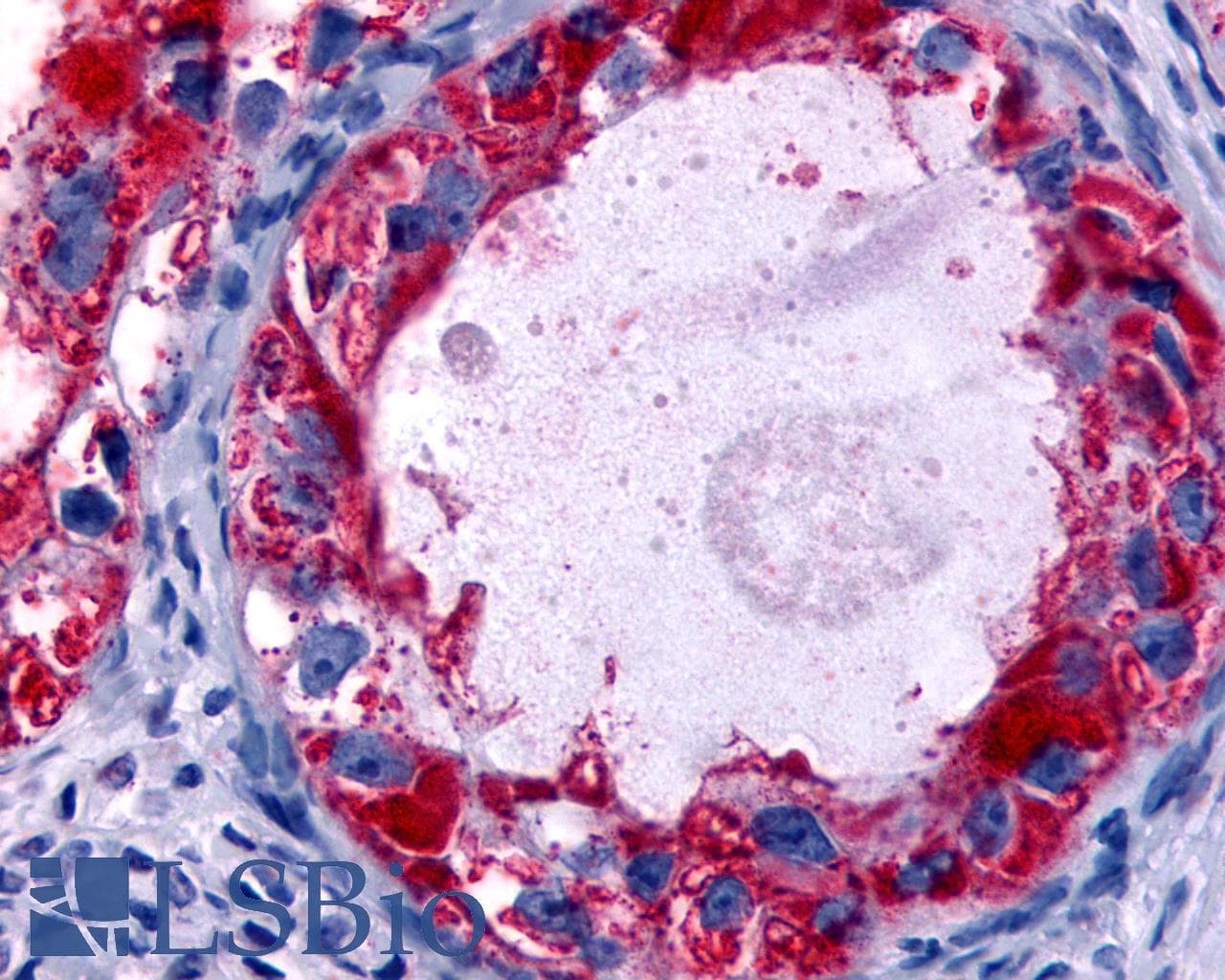 PathPlus™ HRH4 / Histamine H4 Receptor Antibody (Cytoplasmic Domain)