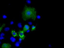 Monoclonal Mouse anti-Human MCL1 / MCL 1 Antibody (clone OTI9C9, IHC, IF, WB)