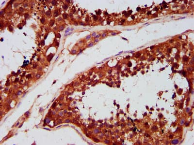 TBC1 / TBC1D1 Antibody