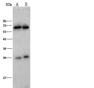ZAP70 Antibody (Preservative Free)