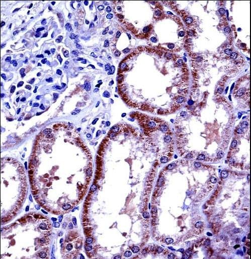 IL6 / Interleukin 6 Antibody (aa27-55)