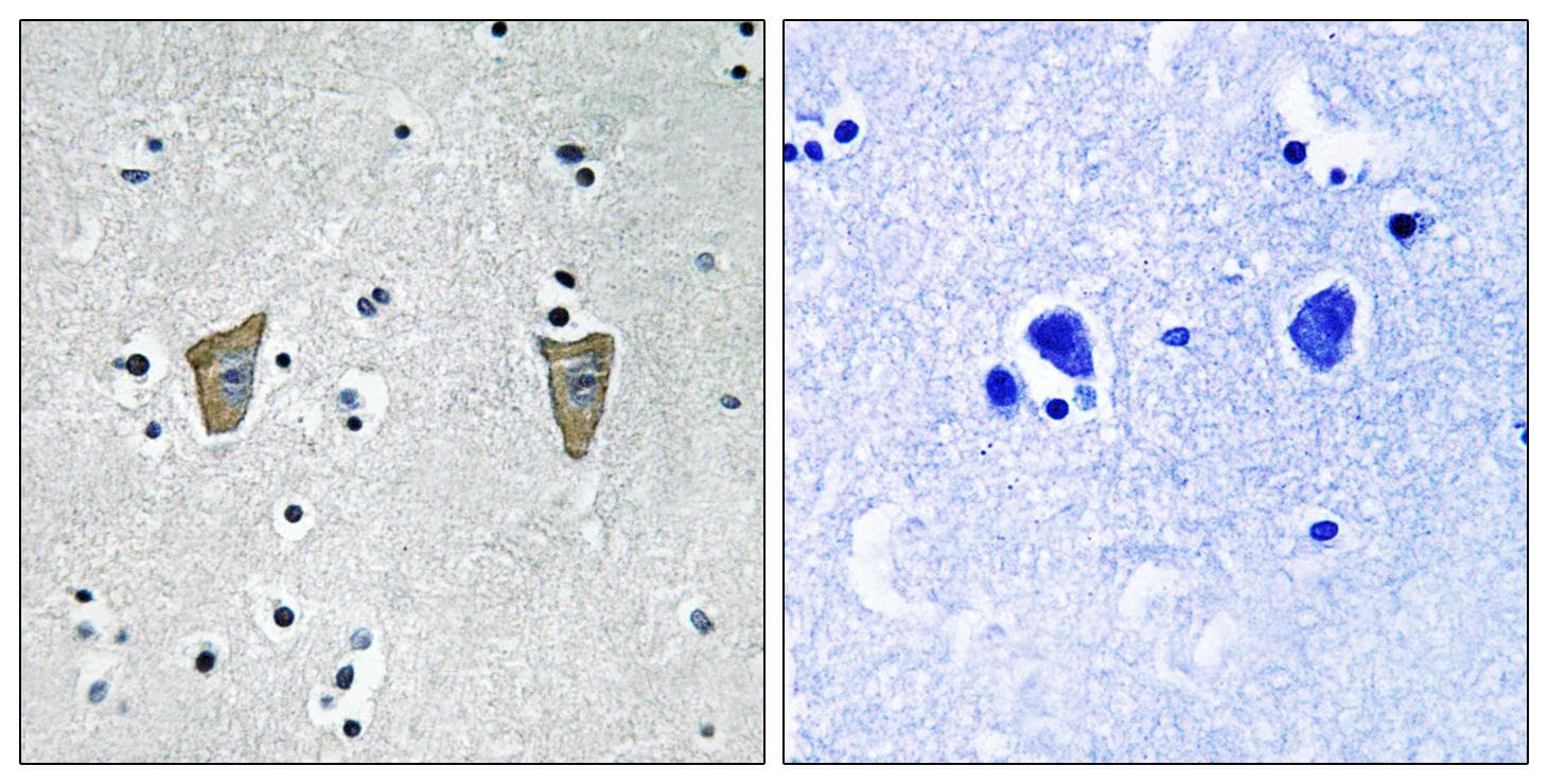 KCNIP3 / Dream / Calsenilin Antibody (phospho-Ser63)