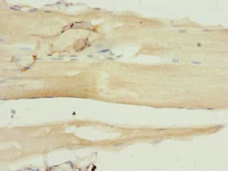 SH2B1 Antibody