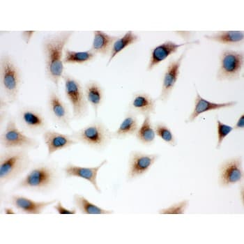 TLR7 / CD287 Antibody (aa1020-1047)