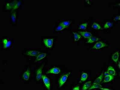 Polyclonal Rabbit anti-Human SIRT7 / Sirtuin 7 Antibody (IHC, IF)