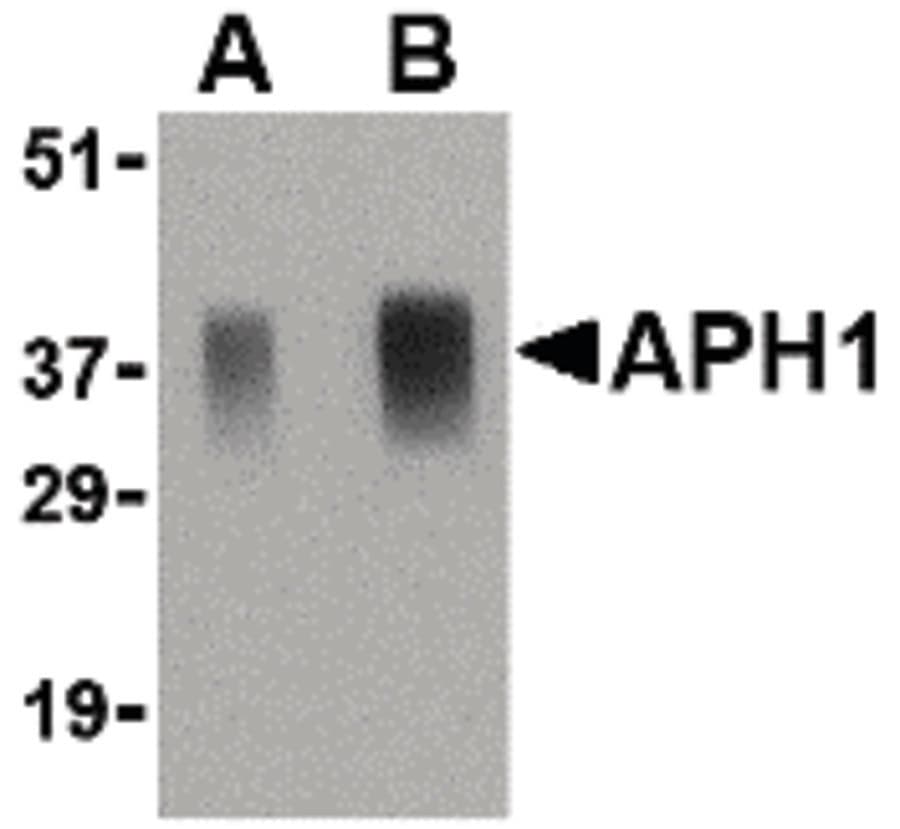 IHC-plus™ Polyclonal Rabbit anti-Human APH1A / APH-1 Antibody (IHC, WB)
