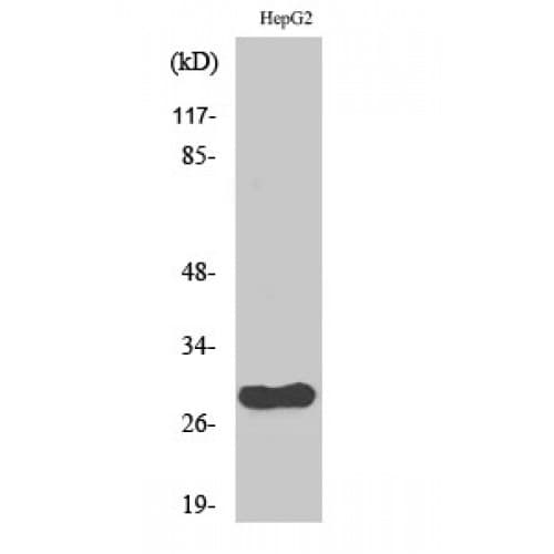CDCA3 Antibody (190-270 aa, C-terminal)