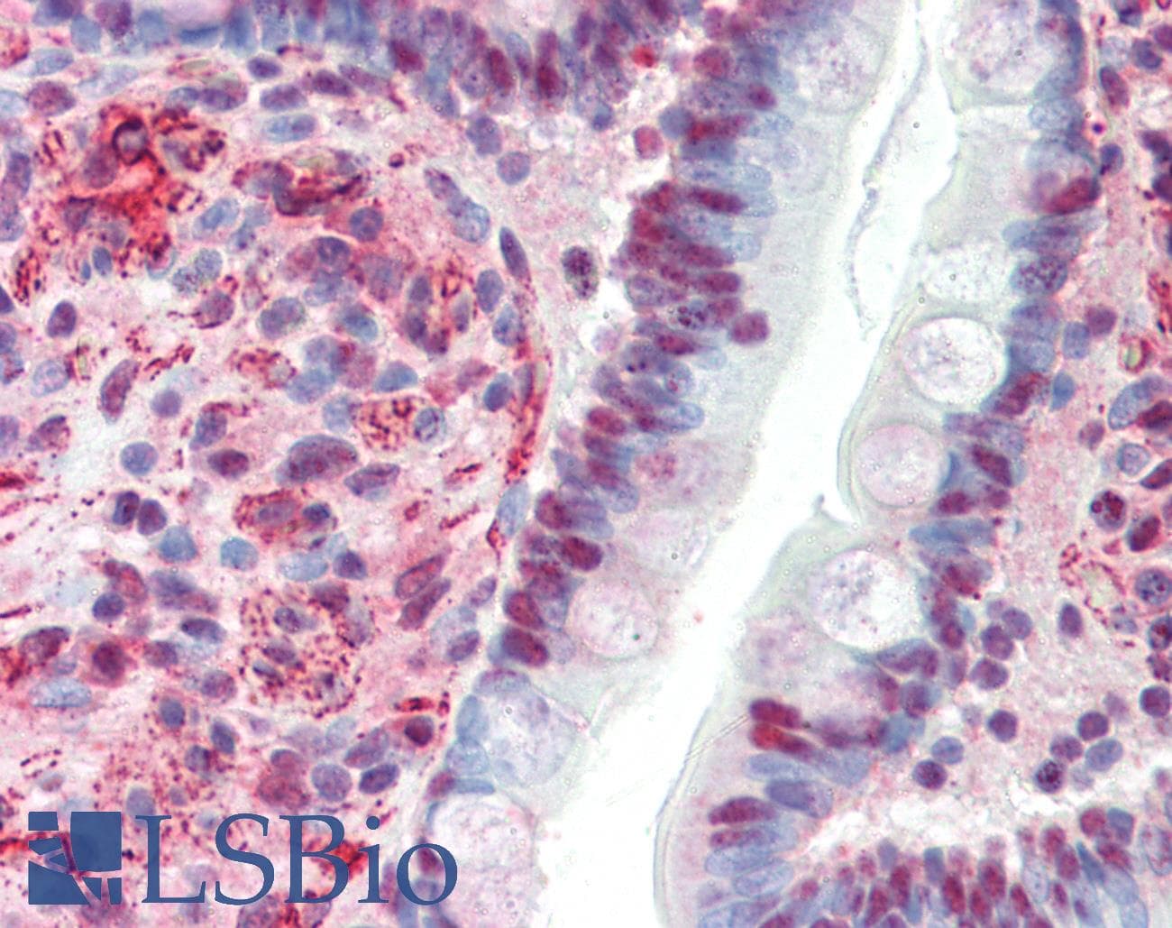 IHC-plus™ ZBTB7B / HcKrox Antibody