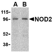 IHC-plus™ Polyclonal Rabbit anti-Human NOD2 / CARD15 Antibody (IHC, IF, WB)