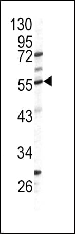 GPT / Alanine Transaminase Antibody (aa86-112)