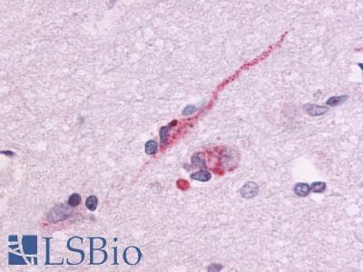 PathPlus™ Polyclonal Rabbit anti-Human GPR83 Antibody (Cytoplasmic Domain, IHC)