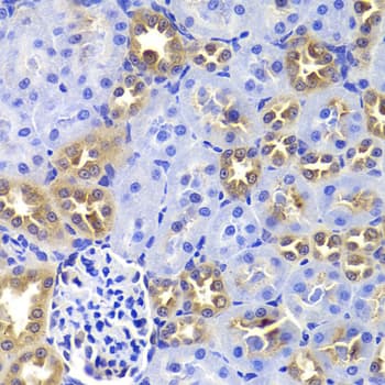 Polyclonal Rabbit anti-Human Gastric Inhibitory Peptide Antibody (IHC, IF, WB)