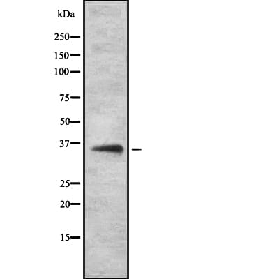 Polyclonal Rabbit anti-Human OR52H1 Antibody (IHC, WB)