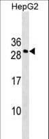 Polyclonal Rabbit anti-Human REDD-2 / DDIT4L Antibody (aa7-34, WB)