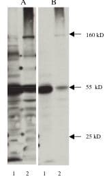 Nitrotyrosine Antibody (clone 2A12)